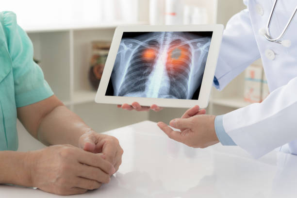 lung
